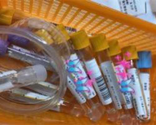 输卵管积水在重庆妇幼保健院做试管，选哪个医生好？