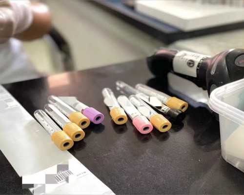 怀孕早期褐色分泌物的处理和影响,私人助孕公司