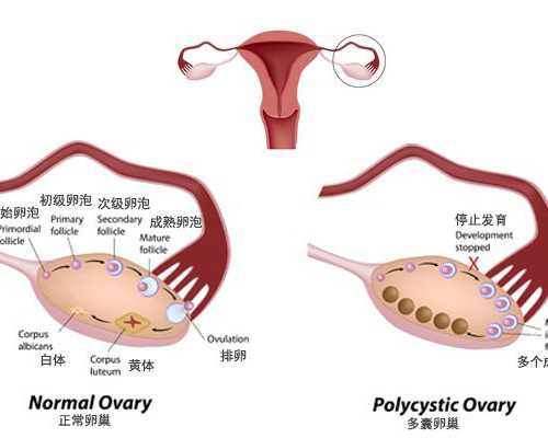 重庆北部妇产联合合川区妇幼保健院开展不孕不育线上继续教育活动