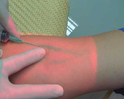 供卵可靠吗哪里有_有没有供卵中心,北京供卵试管多少钱，供卵试管套餐哪里便